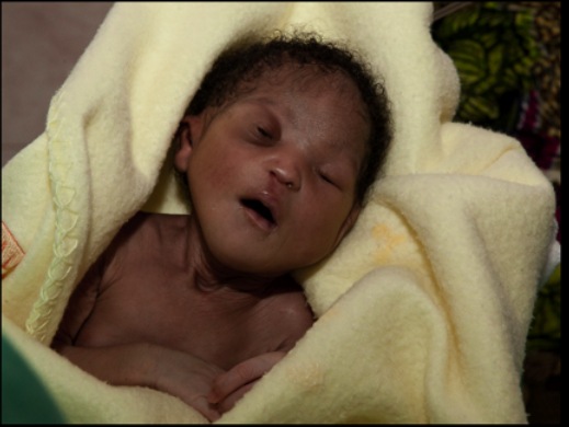Lo que finalmente le pasó al bebé de Guinea Bissau