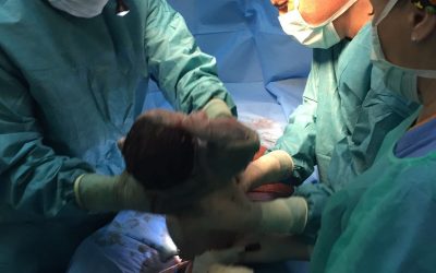 Circuncisiones valientes, cesárea dolorosa y un tumor muy visitado